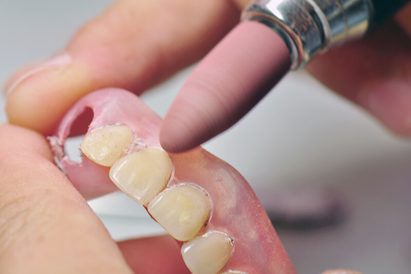 入れ歯の型取り・現状の入れ歯の修理・調整