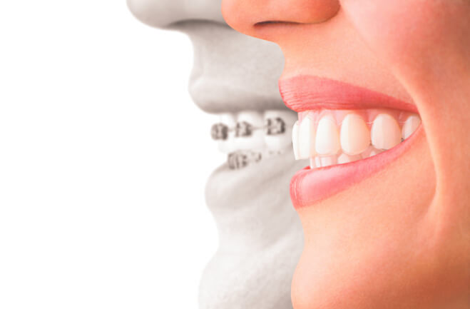 矯正歯科治療は専門医が対応いたします